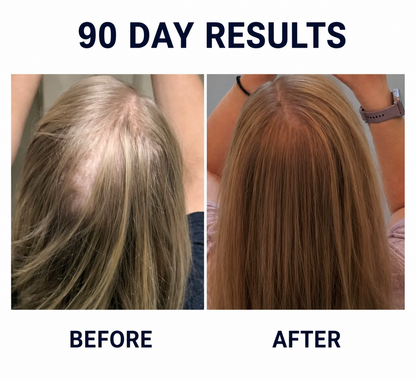 Red Light Therapy Hair Brush - Grow Back Your Hair With 10 Minutes Daily